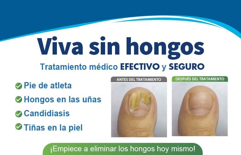 Tratamiento médico para hongos en uñas y pie de atleta en Clínica Médica La Salud